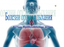 Астма. Бронхиальная астма.  Болезни органов дыхания